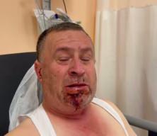 Görgü tanığı hız ve hatalı sollamaya dikkat çekti: 7 ölü, 11 yaralı