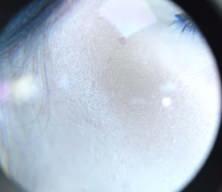 Uzman isim, "Soğuk hava cilt sağlığını nasıl etkiler?" sorusuna yanıt verdi