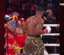 Fenomen boks&ouml;r&uuml;n &ccedil;enesi iki yerden kırılmış: Titanyum plak takıldı