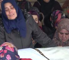 Sa&ccedil; ekimi i&ccedil;in gittiği estetik merkezinde hayatını kaybetti