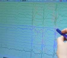 Uzman isim a&ccedil;ıkladı: İşte epilepsinin g&ouml;zden ka&ccedil;an 5 işareti 