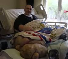 12 yıldır lenf&ouml;demle m&uuml;cadele eden 300 kiloluk Engin Akbadal tedavi i&ccedil;in Ankara&rsquo;ya g&ouml;t&uuml;r&uuml;ld&uuml;