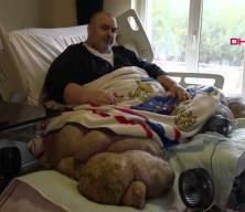 30 kişi tarafından evinden &ccedil;ıkarılan fil hastası, Ankara'ya g&ouml;t&uuml;r&uuml;ld&uuml;.