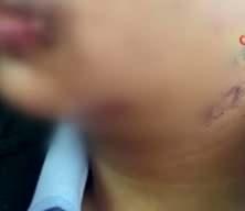 Antalya'da akran zorbalığı y&uuml;rekleri yaktı! Lise &ouml;ğrencisinin &ccedil;enesini kırdılar