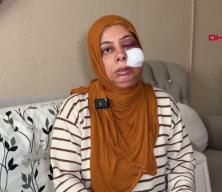 Hatay'da korkun&ccedil; kaza: Dişleri kırıldı, y&uuml;z&uuml;ne 14 dikiş atıldı