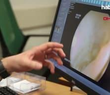 Karın ağrısı ve kabızlık şikayetiyle gittiği hastanede hayatının mucizesini yaşadı