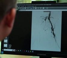 Uzman isim dikkat &ccedil;ekti: 2050'de 3 milyon kişi uzvunu kaybedebilir 