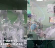 5 bin kilometre uzaktan tarihi operasyon: 5G robotuyla akciğer t&uuml;m&ouml;r&uuml;n&uuml; aldı