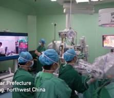 5 bin kilometre uzaktan tarihi operasyon: 5G robotuyla akciğer t&uuml;m&ouml;r&uuml;n&uuml; aldı