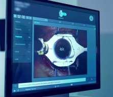 Lazer g&ouml;z cerrahisinde kesin sonu&ccedil; alınabilir mi? Uzman isim anlattı