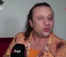 &Uuml;nl&uuml; şarkıcı Onur Akay, ent&uuml;be edildi