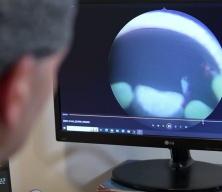 Uzmanlardan kritik uyarı: İdrardaki kanı hafife almayın