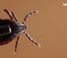 Sivas'ta KKKA hastalığı ş&uuml;phesiyle tedavi g&ouml;ren 21 yaşındaki gen&ccedil; &ouml;ld&uuml;