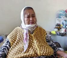 Karnındaki kitleyle 170 kiloya ulaşan kadın 15 yıldır yatağa hasret