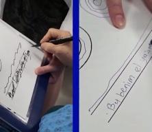 Uzman isim anlattı! Parkinson ve el titremelerinde ameliyatsız tedavi m&uuml;mk&uuml;n