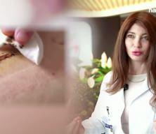 Ameliyat sonrası oluşan yara izlerine modern tedavi y&ouml;ntemleri