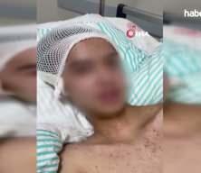  Tacize direndiği iddiasıyla başından vurulan &ccedil;ocuk fel&ccedil; kaldı