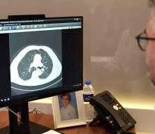 Medipol'den Hepatit B ve C'ye karşı erken tanı &ccedil;ağrısı 