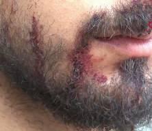 Şanlıurfa'da trafikte 'yavaş gittin' dayağı! Canından oluyordu