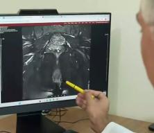 Rektum kanserine ilişkin uzman isim a&ccedil;ıklama yaptı: T&uuml;m&ouml;r tamamen kaybolursa ameliyat şart olmayabilir