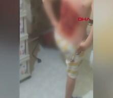 Arnavutk&ouml;y&rsquo;de akran dehşeti! 12 yaşındaki &ccedil;ocuğu yaktılar