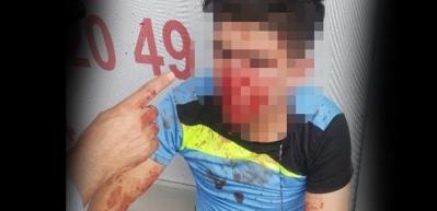 Tacizciye sokak ortasında meydan dayağı