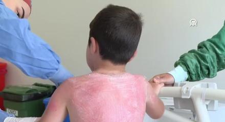 4 saat güneşte kalan 7 yaşındaki çocuk hastanelik oldu