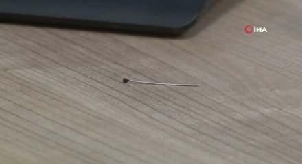 Ağrıyla kıvranan 2 yaşındaki çocuğun bağırsağından 3 santimlik iğne çıktı