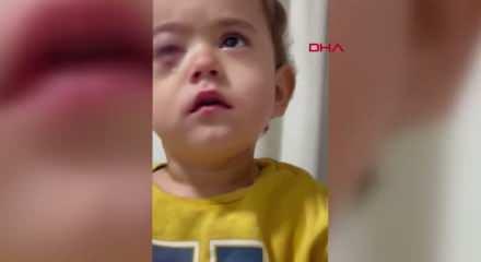 Bursa'da torpil faciası! 2 yaşındaki çocuk gözünden oldu