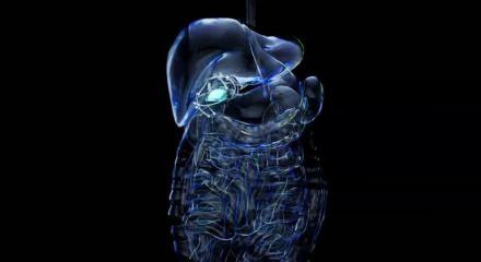 Hazımsızlık deyip geçmeyin: Altında safra kesesi taşı olabilir