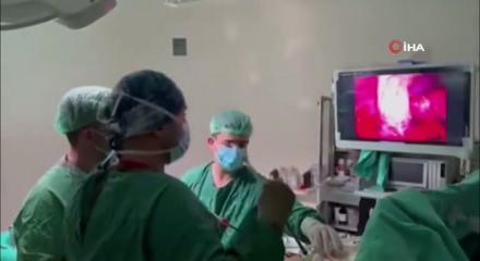 Safra kesesinden 20 binin üzerinde taş çıktı! İşte o görüntü...