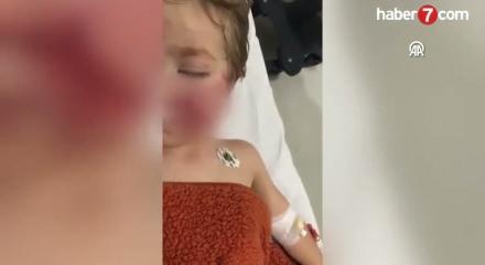 Ankara’da pitbull saldırısı: iki kardeş yaralandı