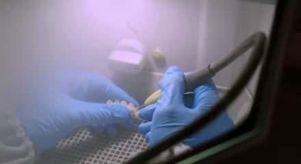 MHP, implant tedavisinin SSK kapsamına girmesi için kanun teklifi önerdi