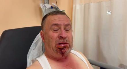 Görgü tanığı hız ve hatalı sollamaya dikkat çekti: 7 ölü, 11 yaralı