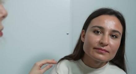 Uzman isim uyardı: Yetişkinler akne sorunuyla karşı karşıya