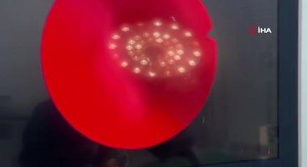 Yıllarca fark etmedi, estetik ameliyatta ortaya &ccedil;ıktı: Burunda rinolit şoku!