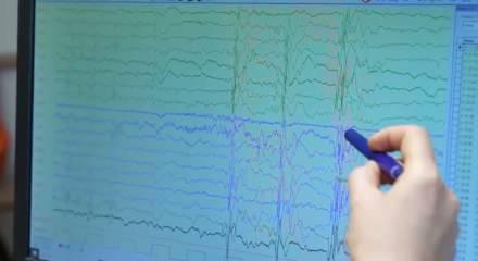 Uzman isim a&ccedil;ıkladı: İşte epilepsinin g&ouml;zden ka&ccedil;an 5 işareti 