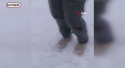 Kayseri&rsquo;de başıboş k&ouml;peğinin saldırısına uğrayan &ccedil;ocuk yaralandı