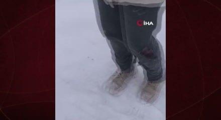 Kayseri&rsquo;de sokak k&ouml;peğinin saldırısına uğrayan &ccedil;ocuk yaralandı