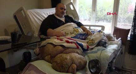 30 kişi tarafından evinden &ccedil;ıkarılan fil hastası, Ankara'ya g&ouml;t&uuml;r&uuml;ld&uuml;.