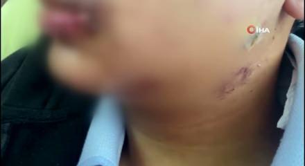 Antalya'da akran zorbalığı y&uuml;rekleri yaktı! Lise &ouml;ğrencisinin &ccedil;enesini kırdılar