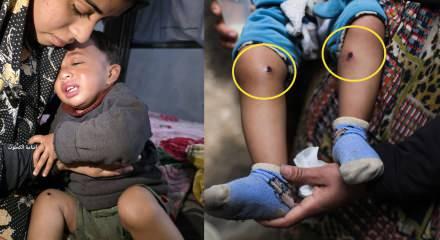 İsrail askerlerinden babayı itirafa zorlamak i&ccedil;in 1,5 yaşındaki bebeğe işkence