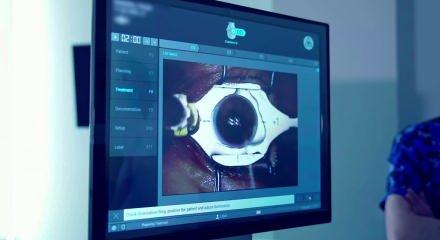 Lazer g&ouml;z cerrahisinde kesin sonu&ccedil; alınabilir mi? Uzman isim anlattı