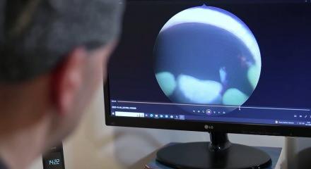 Uzmanlardan kritik uyarı: İdrardaki kanı hafife almayın