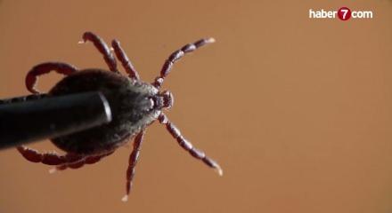 Sivas'ta KKKA hastalığı ş&uuml;phesiyle tedavi g&ouml;ren 21 yaşındaki gen&ccedil; &ouml;ld&uuml;