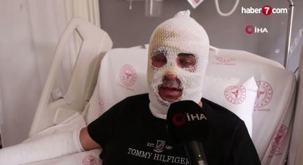 Hatay'da yangına m&uuml;dahale sırasında patlama! Y&uuml;z&uuml; ve v&uuml;cudu yandı