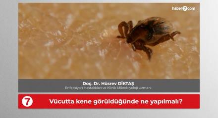Uzman isimden kene uyarısı: V&uuml;cuttan en kısa s&uuml;rede uzaklaştırılmalı!