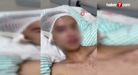  Tacize direndiği iddiasıyla başından vurulan &ccedil;ocuk fel&ccedil; kaldı