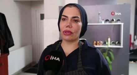 Bakım merkezinde burnu kırıldı, iyileşmek i&ccedil;in ge&ccedil;irdiği 4 operasyon sonrası hayatı kabusa d&ouml;nd&uuml;