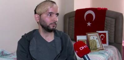 Titanyumdan kafatası yapılan gazi: 'Ger&ccedil;ek &ouml;d&uuml;l&uuml; kafamda taşıyorum'